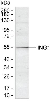 ING1